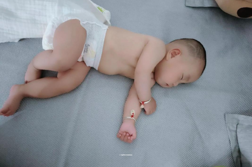 北京宝宝头上长痱子